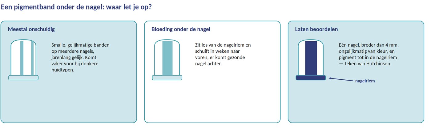 Drie nagels naast elkaar